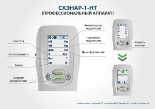 СКЭНАР-1-НТ (исполнение 01)  в Орле купить Медицинская техника - denasosteo.ru 